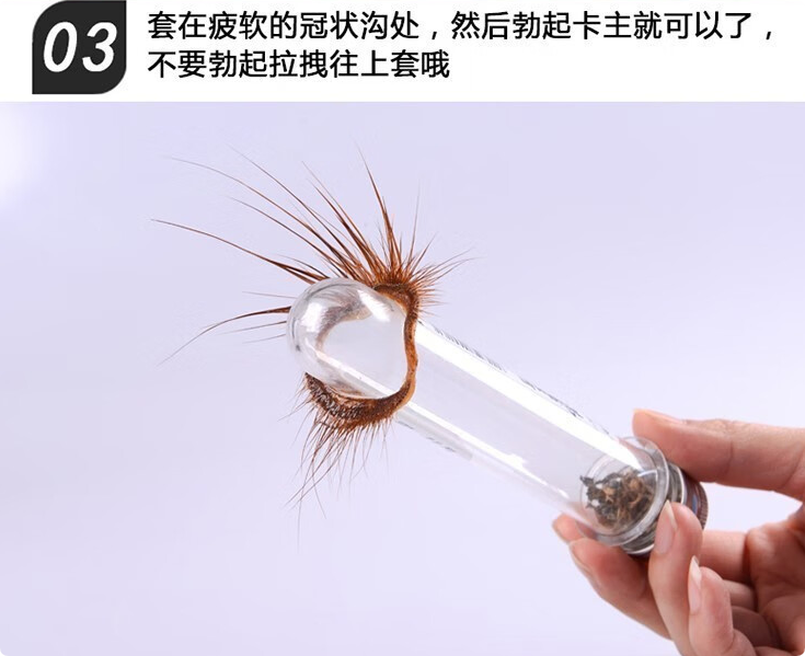 佩戴部位冠状沟