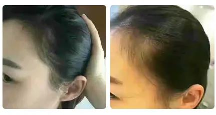 0a8139a7a45d9a57d7fcaee1ecc34bbe.png