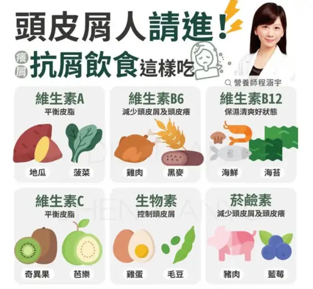 换洗发水还是有头皮屑？营养师：6大营养素护头皮